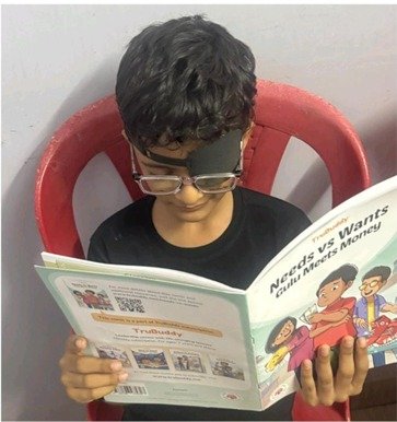 Amblyopia
