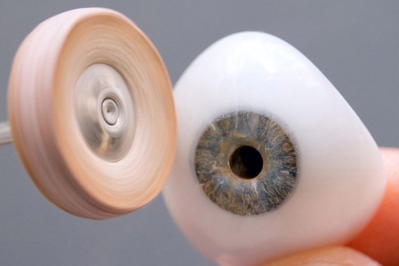 Ocular Prosthetic Lab